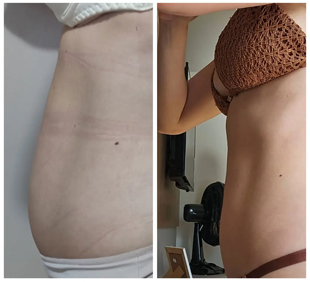 FOTOS-ANTES-E-DEPOIS-THIAGO-5